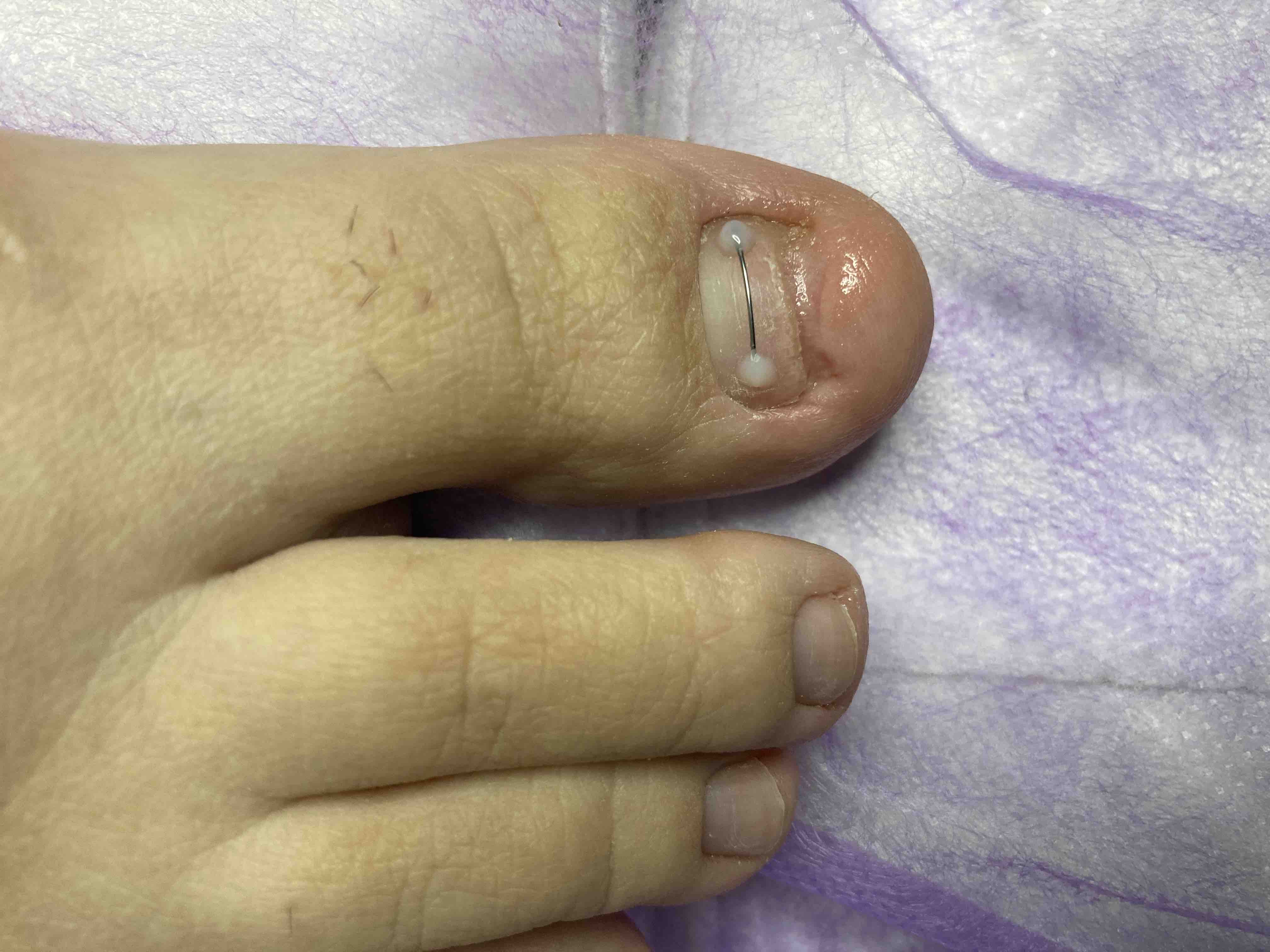 8120